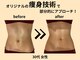 ジンク(ZINC)の写真