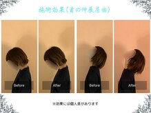 ボディ リセット アンド デザイン(Body Reset & Design)/【施術例】ビフォーアフター