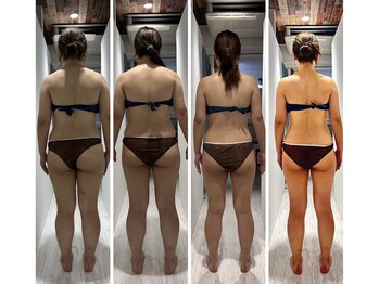 ローメル(LOWMEL)/