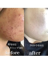 メジェール/美肌・エイジングケア