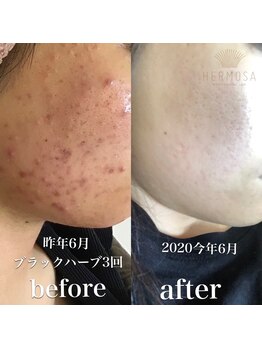 メジェール/美肌・エイジングケア