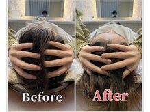 整体ラルース 中目黒(LALUZ)/20代 女性 小顔ヘッドスパ　変化