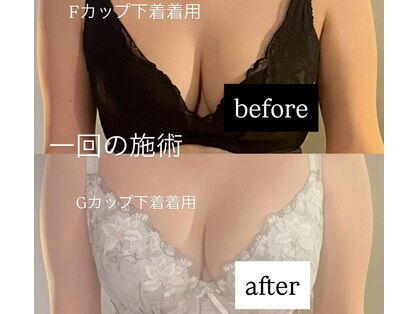 ピウ(PiU)の写真
