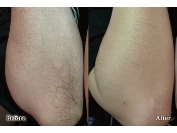 アネル オム 新都心店(ANEL HOMME)/