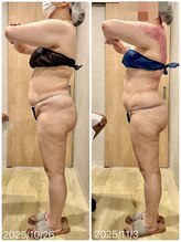 スピード美人 本八幡店/全身コース２回でこの変化