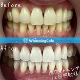 ホワイトニングカフェ 黒崎店(WhiteningCafe)