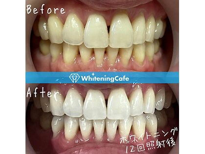 ホワイトニングカフェ 黒崎店(WhiteningCafe)の写真