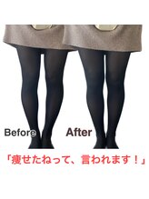 【医療提携】首肩こり・腰痛整体・マシンピラティスASABA整体院/新松戸店/O脚改善★結果写真