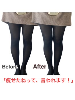 【医療提携】首肩こり・腰痛整体・マシンピラティスASABA整体院/新松戸店/O脚改善★結果写真