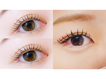 グローバルネオ(GLOBAL NEO)の写真