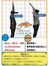 ナオル整体 山形天童院(NAORU整体)/【肩コリ改善】可動範囲UP!