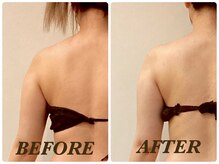 プリマ 栄店(Prima)/【2回施術】　BEFORE＆AFTER