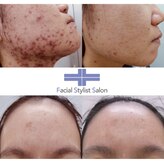 フェイシャルスタイリストサロン 高崎店(Facial Stylist Salon)