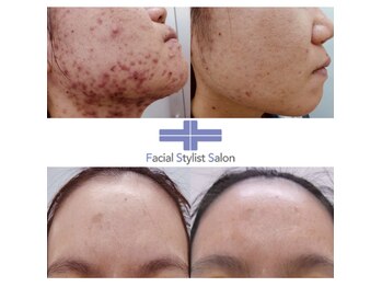 フェイシャルスタイリストサロン 高崎店(Facial Stylist Salon)