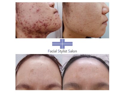 フェイシャルスタイリストサロン 高崎店(Facial Stylist Salon)の写真