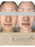  【毛穴集中改善トリートメント】自然由来スクラブ＋高濃度ビタミン導入