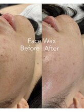 ハリウッドブロウリフト ワクシー 表参道店(HOLLYWOOD BROW LIFT WAXYYY.)/速攻ウル艶肌!フェイスワックス