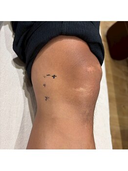 グレフル鍼灸接骨院 整体院 心斎橋/整体/肩こり/マッサージ/腰痛