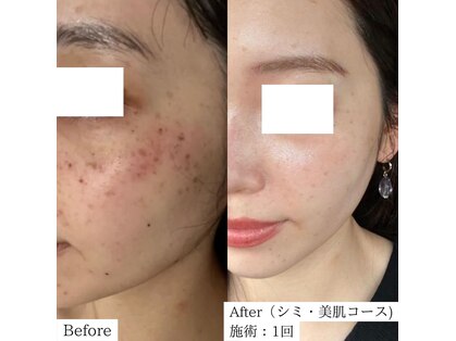 エヌプラスビューティー(N+beauty)の写真