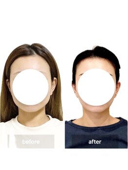 オルネ(ORNE.)の写真/【脳疲労ケア】疲れた脳を癒す極上ヘッドスパ◇     頭の重だるさ・眼精疲労をスッキリ解消！
