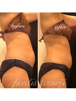 ファビリス 天王寺店(FAVILIS)/オーダーボディ5回/50代