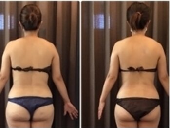 美容整体ウェリナ あま甚目寺院/小顔矯正/骨盤矯正/美脚サロン