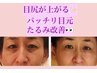 【オプション】毎月ご来店の会員様限定☆目元高周波&EMS集中10分をプラス