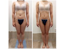 アイディエム 新宿店(IDM)/【モニター】150ｃｍ・20代