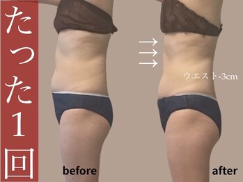 モア 多治見店(MORE)/お客様ビフォーアフター