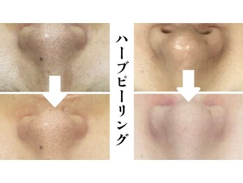 ラビエス(LAVIES)