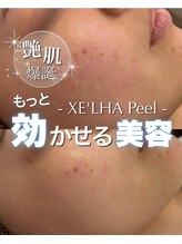 ジェノール 飾磨本店(JNOEL)/人気の韓国美容！セラピール