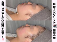 オンダリフト東京 大阪梅田店【韓国肌管理】オンダリフト/ララ ピール/小顔矯正/痩身の雰囲気(オンダリフト/ララピール/ハーブピーリング/小顔矯正/毛穴/痩身)