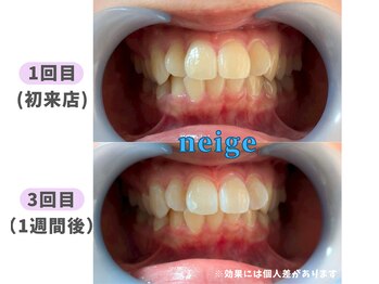 ネージュ(neige)/10代後半/女性/お茶1日3杯