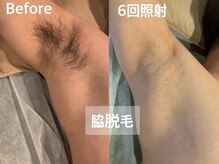 アンダンテ(Andante)の雰囲気（清潔感・印象UP◎メンズ脱毛もお任せ♪）