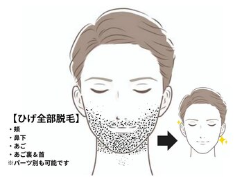 メンズ エステティック ヒーロー(men's esthetic HERO)/ヒゲ脱毛の範囲