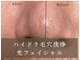  Lashenlanka四日市【ラシェンランカ】リラクゼーションマッサージ/フェイシャル/脱毛の写真/《ビジネスシーンでもパッと目を引く、爽やかな印象へ》本格毛穴洗浄で気になるお肌の黒ずみを改善◎