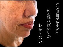 セレブリボーン 大阪ボーテ
