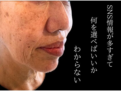 セレブリボーン 大阪ボーテの写真