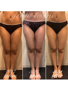 ファビリス 天王寺店(FAVILIS)/オーダーボディ/20代