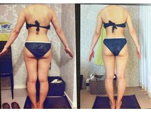 パーフェクトボディプレミアム 大阪梅田店(PERFECT BODY PREMIUM)/お客様　ビフォーアフター（6）