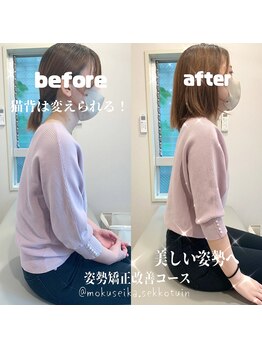 木犀花/姿勢矯正改善コース 要町駅/整体