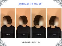 ボディ リセット アンド デザイン(Body Reset & Design)/【施術例】ビフォーアフター