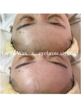 シェリー(Cherie)/フェイシャルワックス おでこ