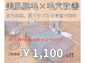サンテ(Sante)