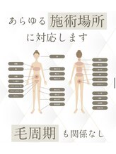 サロンリアンジュ ひたちなか店(Salon Liange)/都度払い！レデース☆全身脱毛