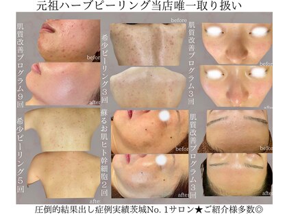 プラウディア(PROUDIA)の写真