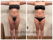 ミ ライト(m light)/