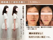 小顔矯正＆姿勢矯正/骨格,根本からの美容施術もお任せください◎