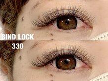 アイネ(i:Ne)/バインドロック