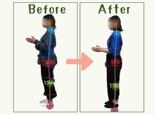 【痩身/ダイエット/整体/骨盤矯正】専門サロン アテオス/30代　腰痛・頭痛・肩こり